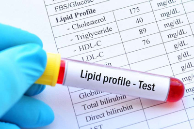 lipid